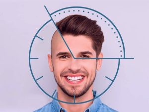 Hoe lang duurt een haartransplantatie operatie?