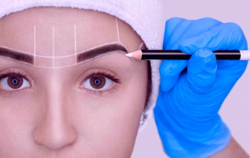 Welke gebieden kunnen behandeld worden met een haartransplantatie?