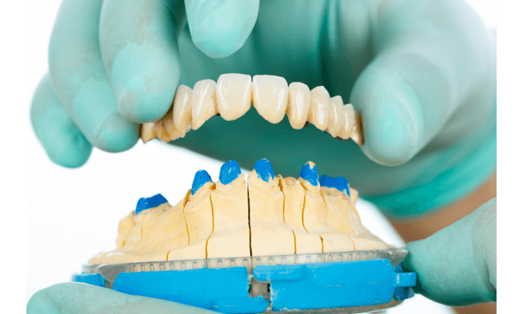 why teeth replacement is worthful