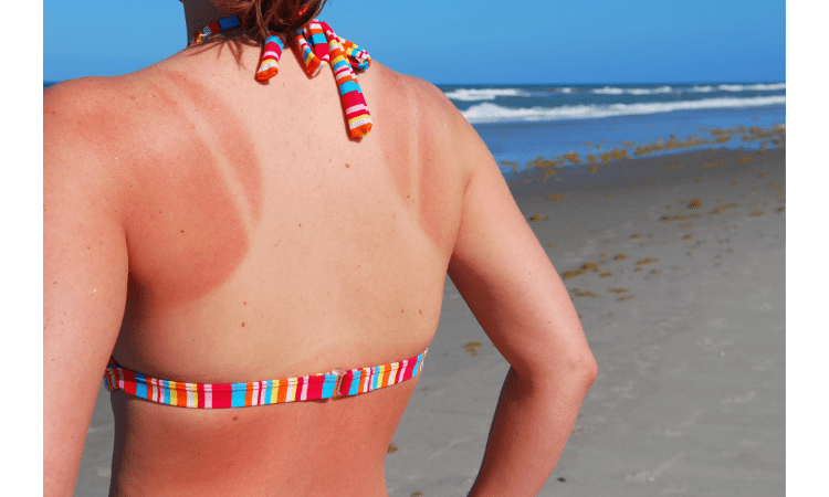 Sun Protection Tips and Myths