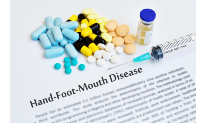 Hand Foot and Mouth Disease