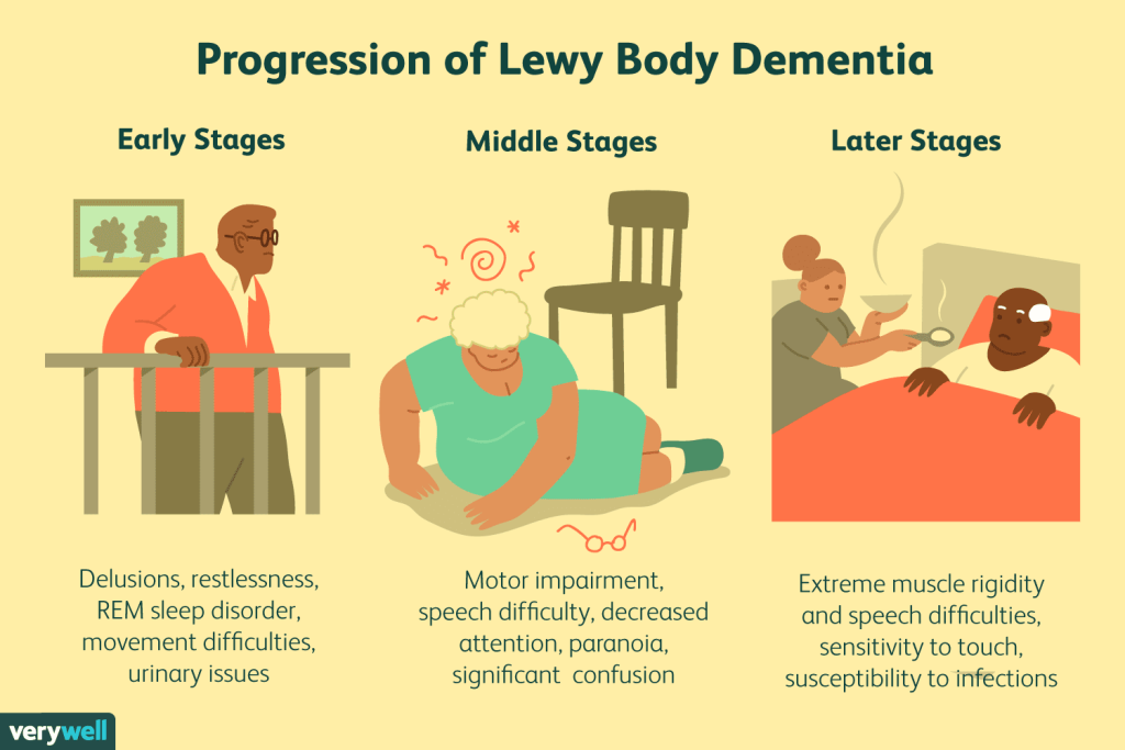 What are the symptoms of Dementia