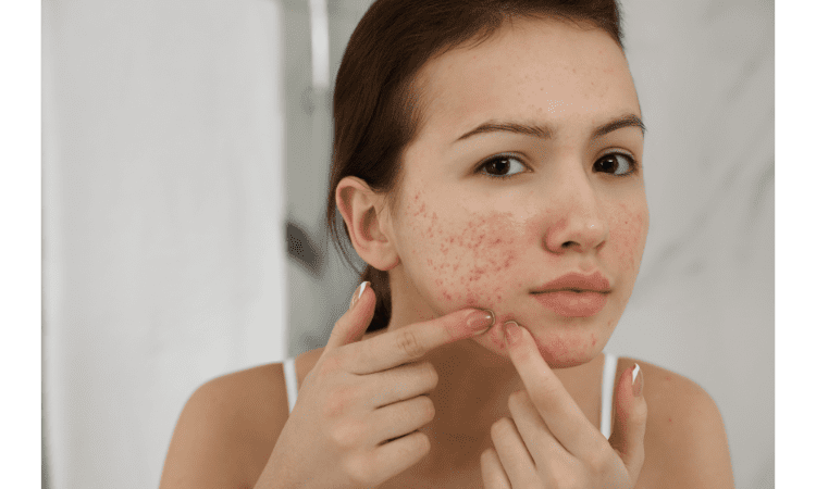 why you should be icing your face