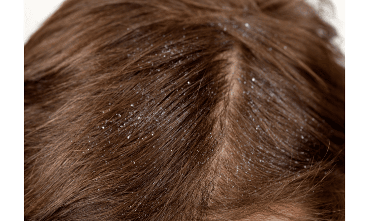 benefits of jojoba oil