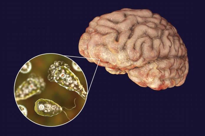Brain-eating amoeba infection, illustration Know About Brain Eating Amoeba