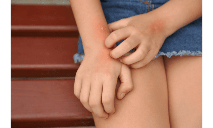 side effects of insect repellents
