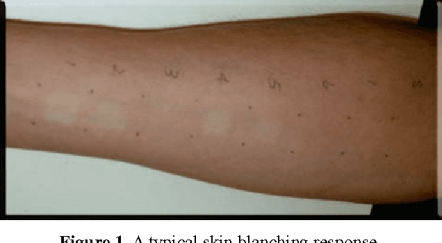 Can skin blanching help diagnose rash severity