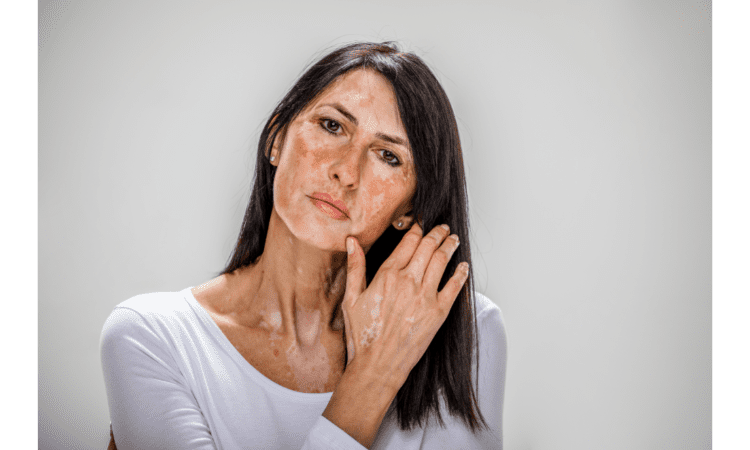 Benefits of black seed oil for skin