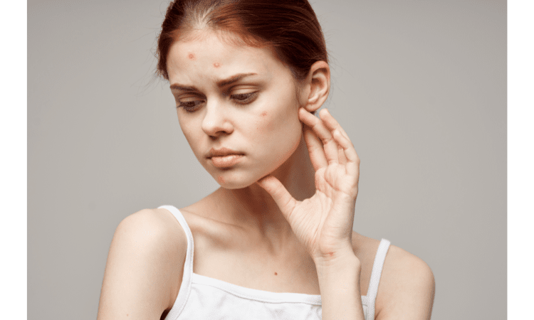 Benefits of black seed oil for skin
