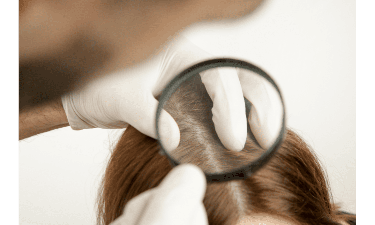 Glycerin The Secret to Natural Solution for Strong Healthy Hair growth 