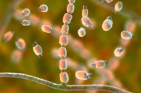 valley fever heading The Hidden Danger of Valley Fever What You Need to Know