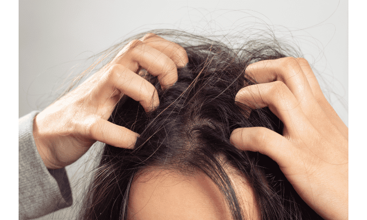 Hair loss from hard water in your shower