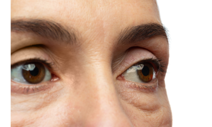 Untitled design - 2023-07-01T170749.516 Skincare Experts & Nutritionists: Worst Beverages for Puffy Eyes