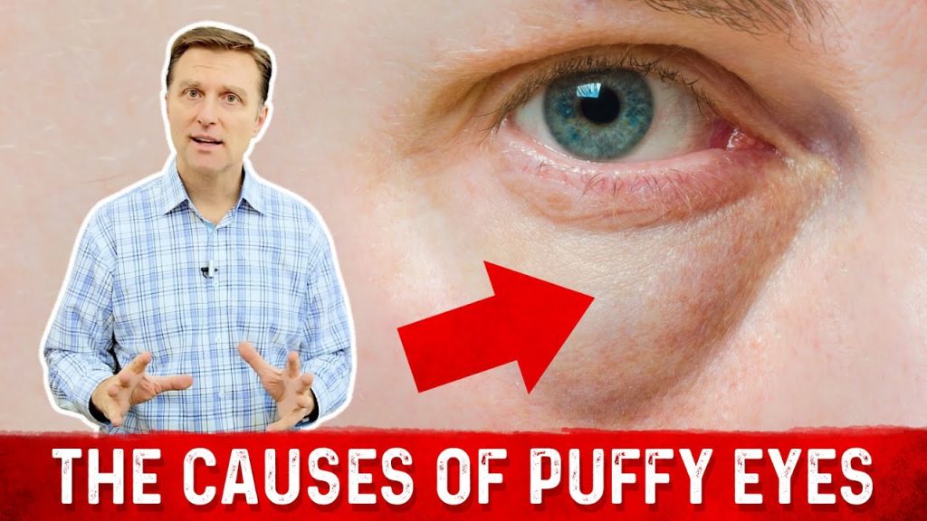 Skincare Experts & Nutritionists: Worst Beverages for Puffy Eyes