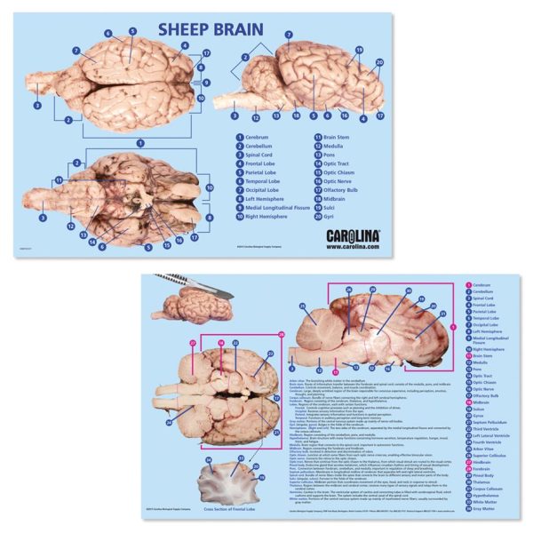 Dissektionsmatta - Hjärna