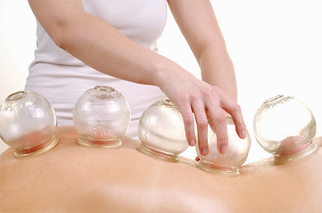 Cupping massage mobile