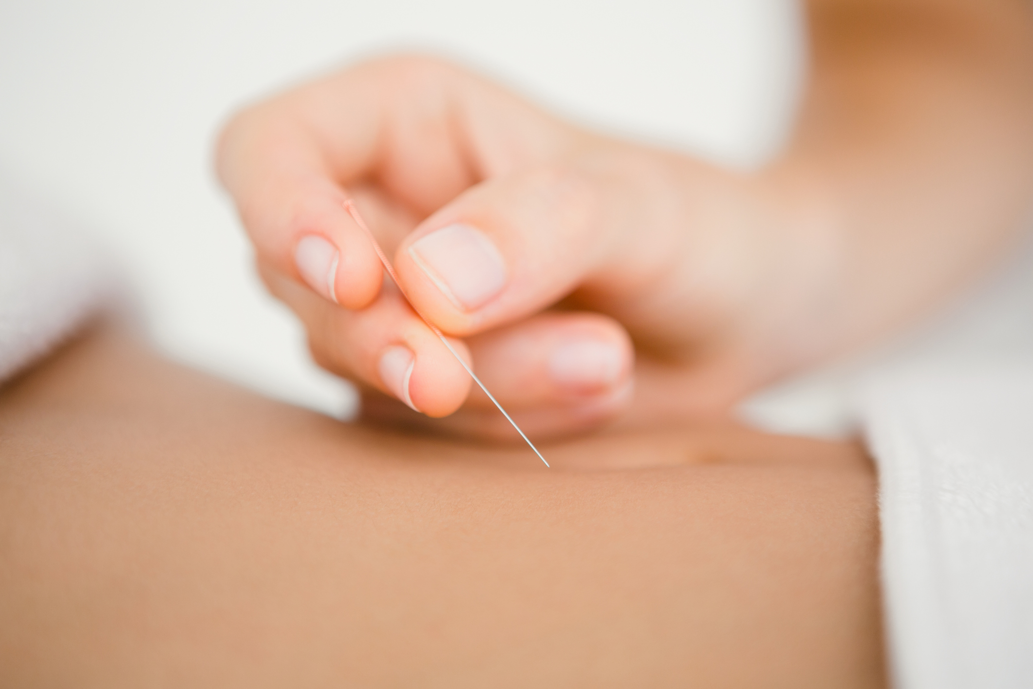 acupunctuur therapieën, naald in de buik