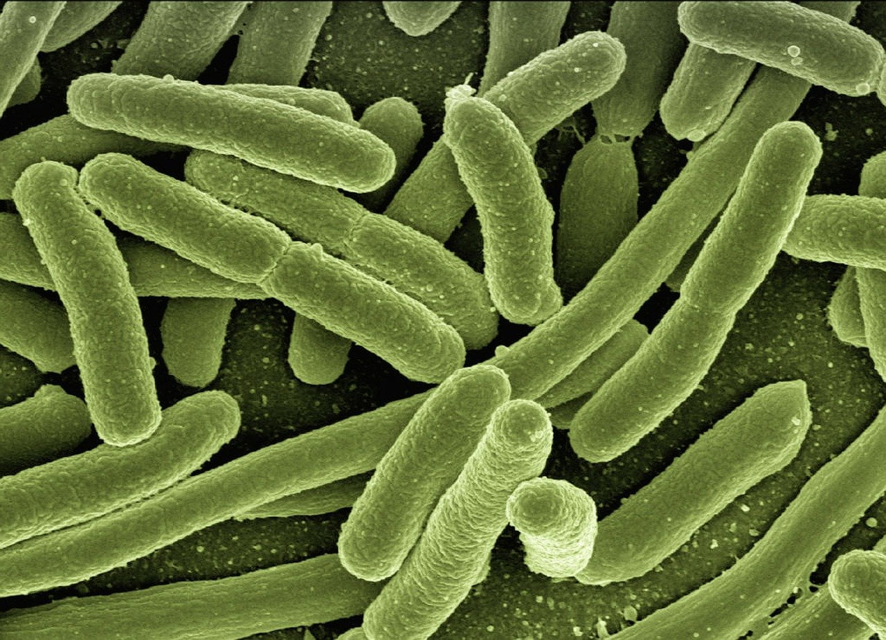 koli bacteria, escherichia coli, bacteria-123081.jpg