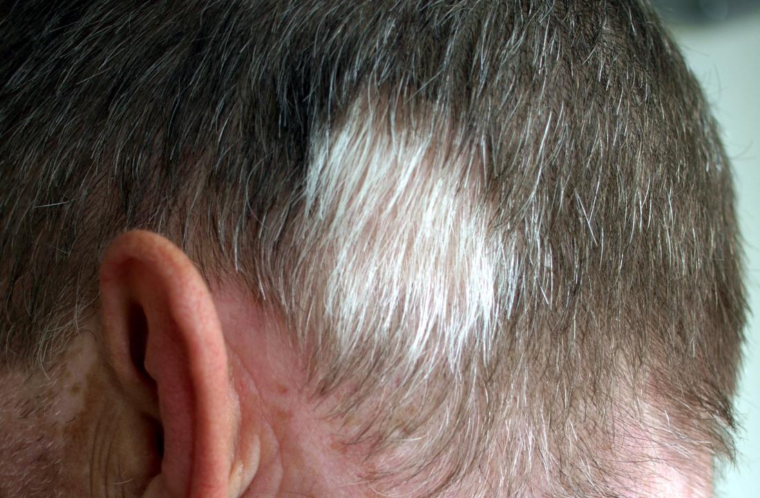 Causes of White Hair in Blondes - wide 3