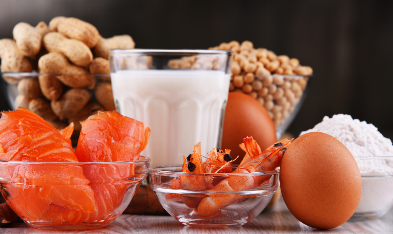Food Intolerance Test Malmo