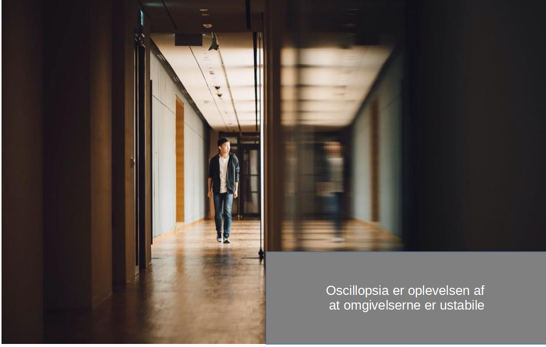 Migræne med svimmelhed (Vestibulær migræne)
