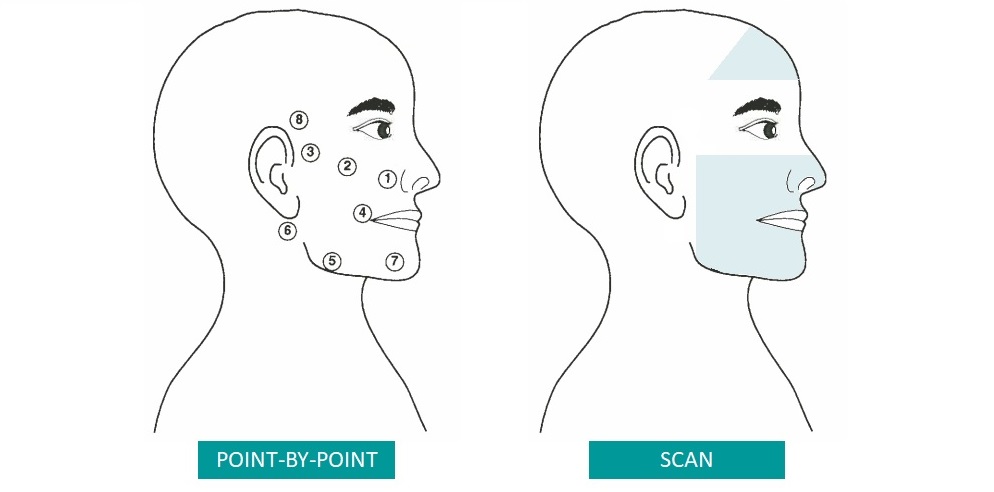 MLS® laserterapi mod ansigtslammelse ved hjælp af laser behandling via forskellige punkter i ansigtet eller via MLS® scanning 