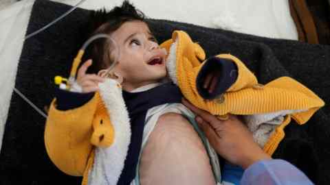 Palestinian boy Ahmed Qannan,  suffering from malnutrition, is attended to at a healthcare centre in Rafah