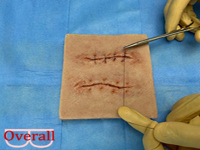 Portable suture removal application