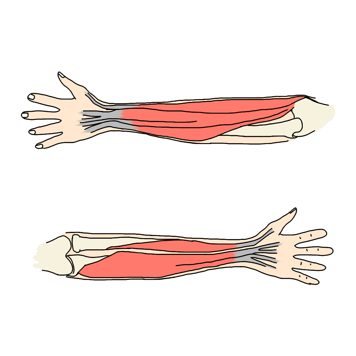 Read more about the article Tennis Elbow