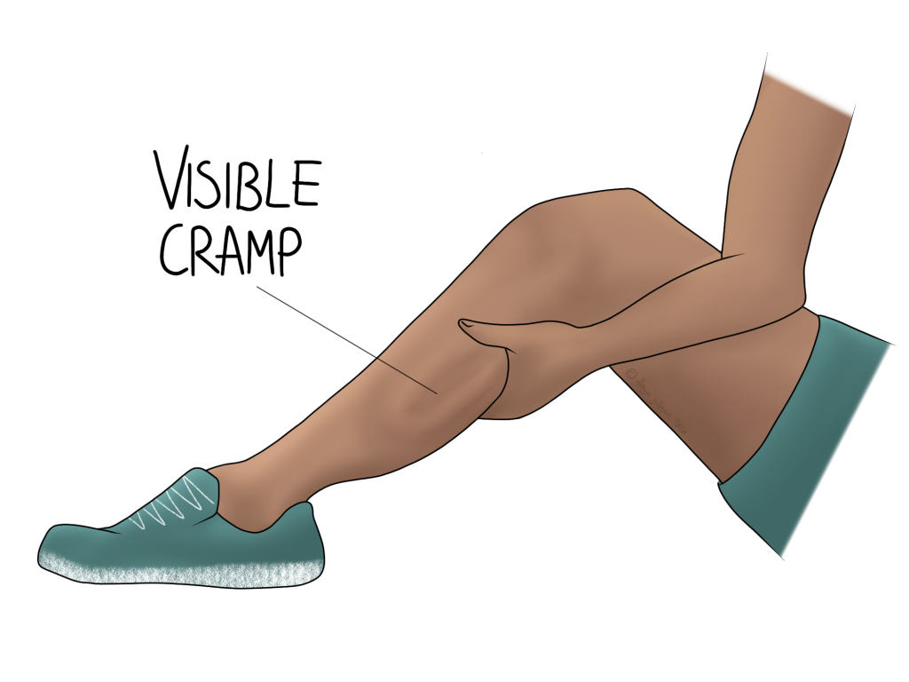 Muscle cramps