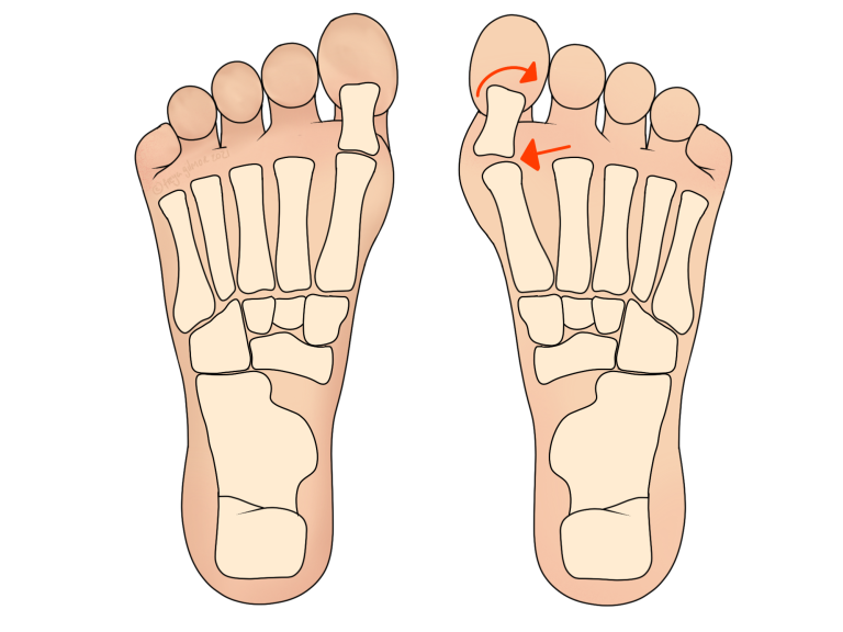Read more about the article Foot and Ankle Problems