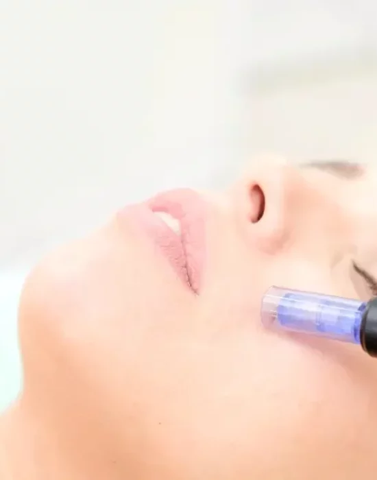 frau microneedling facial gesichtsbehandlung kosmetik kosmetikstudio in saarbruecken saarland