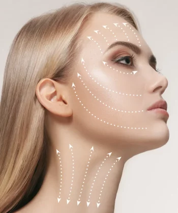 Profhilo is a stabilised injectable hyaluronic acid indicated for the treatment of tissue remodelling and skin laxity, free of any chemical crosslinking agents.