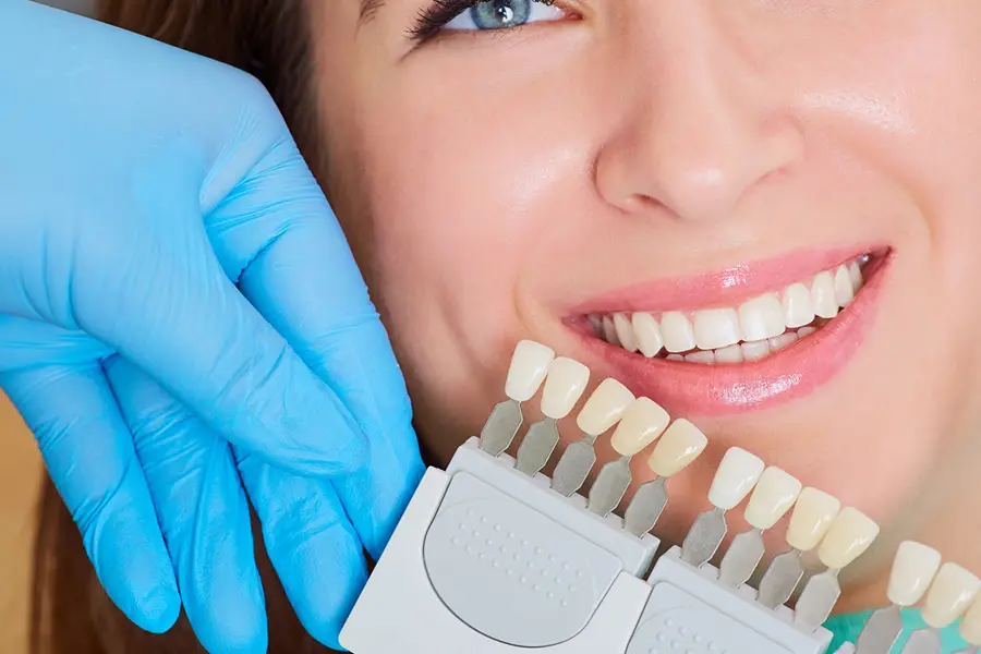 A lady receiving a private treatment at Bicester Dental, she is smiling and her teeth are being compared to a colour chart.