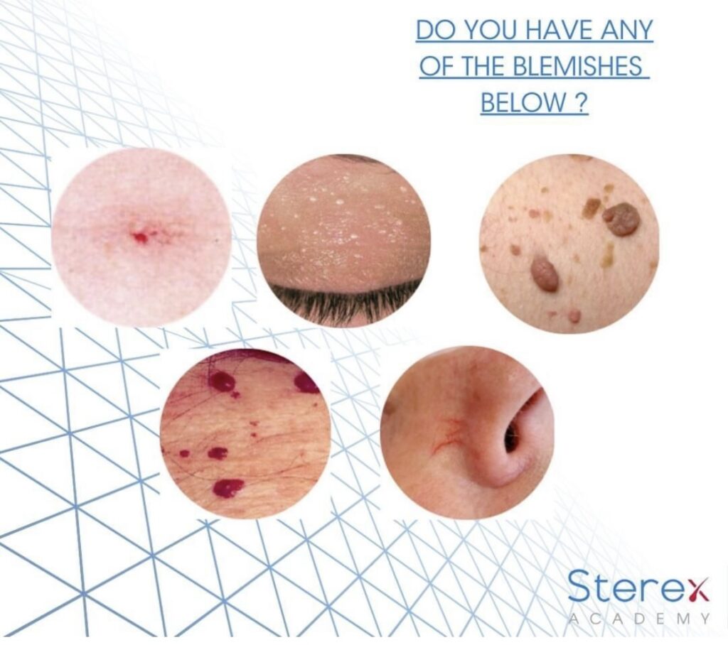 A series images showing examples of blemish on the skin, on a white background with a blue geometric pattern fading into the distance.