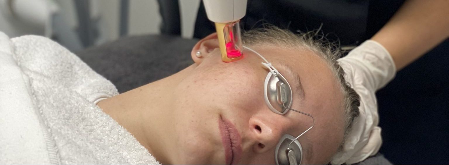 m22 resurfx laser apparaat bij bodysilk