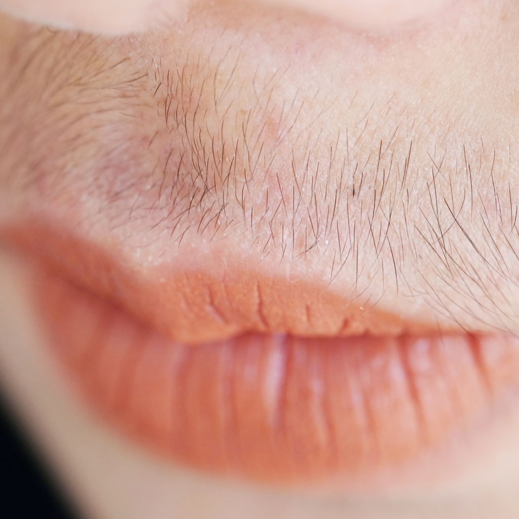 Yalangoch eshaklar va kokraklar