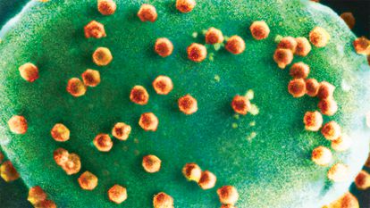 A microscope shows viral particles of the chlorovirus infecting microscopic algae. The virus attacks and decomposes the chlorophyll, releasing the carbon within. 