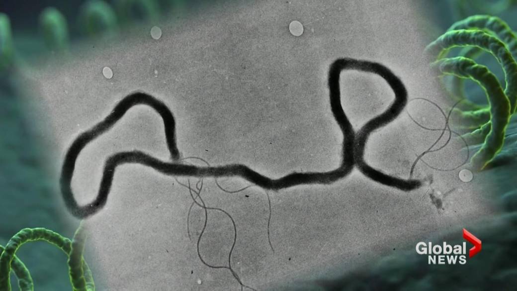 Click to play video: 'Syphilis cases nearly triple in Saskatchewan'