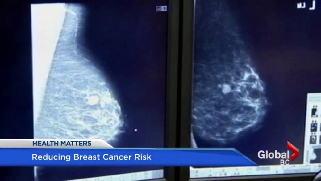 Click to play video: 'How women at high risk of breast cancer can reduce their risk'
