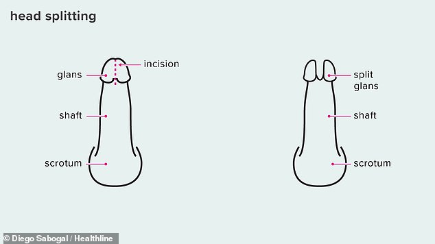 A less common genital procedure that Dr Crane did not detail is called penile splitting, a type of body modification that splits the penis into two separate sections at various points. It is not known if the clinic performs this