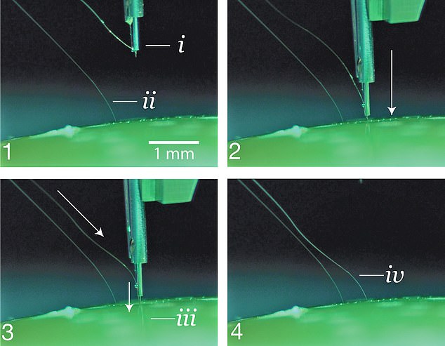 The ¿sewing robot¿ removes a small chunk of the skull, connects the thread-like electrodes to certain areas of the brain, stitches up the hole and the only visible remains is a scar left behind from the incision