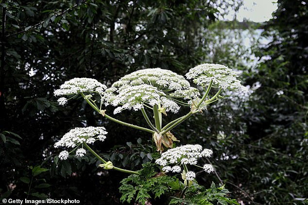 Giant hogweed is one of the UK's most dangerous plants, with sap that can cause painful burns and blisters