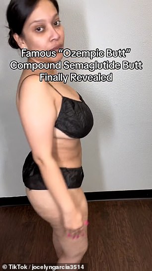 'Keep in mind I had a BBL about seven years ago and this is what my butt looks like after my 16th injection of compound semaglutide,' she added