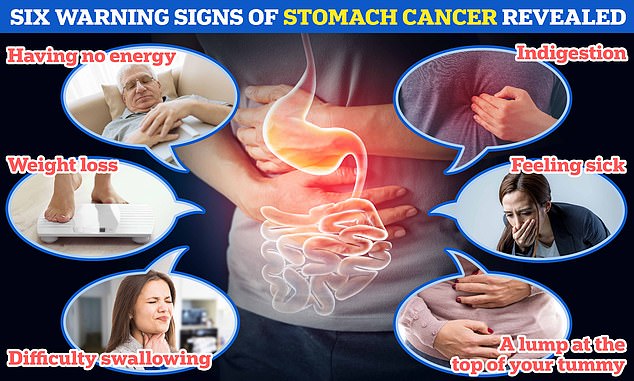 Experts young people may ignore symptoms of stomach cancer meaning cases are not diagnosed until the disease is advanced and incurable