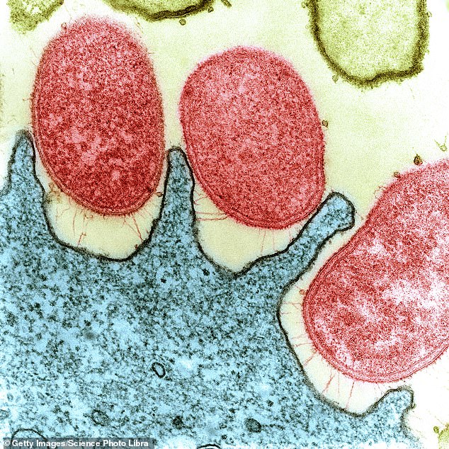 A coloured microscope image of a human stomach (blue) infected with Helicobacter pylori bacteria (red)