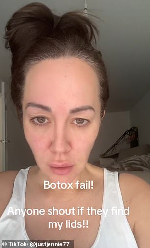 Social media user @justjennie77 shared her Botox Mishap to TikTok to warn others of the potential side effects. The video shows her revealing her slightly drooped eyelids, which she claims is a dramatic change to her previously 'really good' eyelids