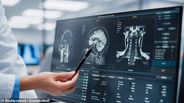 Mrs Chavez was diagnosed with stage four lung cancer which means that by the time medics discovered she had the disease it had already spread beyond the lungs. Stock image