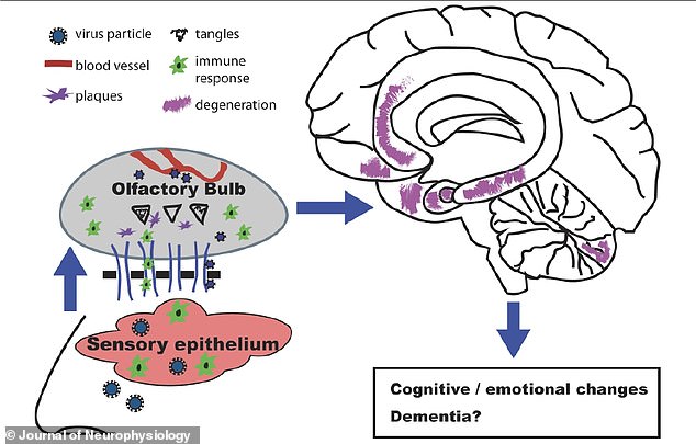 Viruses are thought to cause dementia by triggering the build up of amyloid plaques which can lead to degeneration in the brain and years later, potentially Alzheimer's