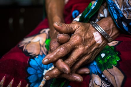 The hands of Razia Begum